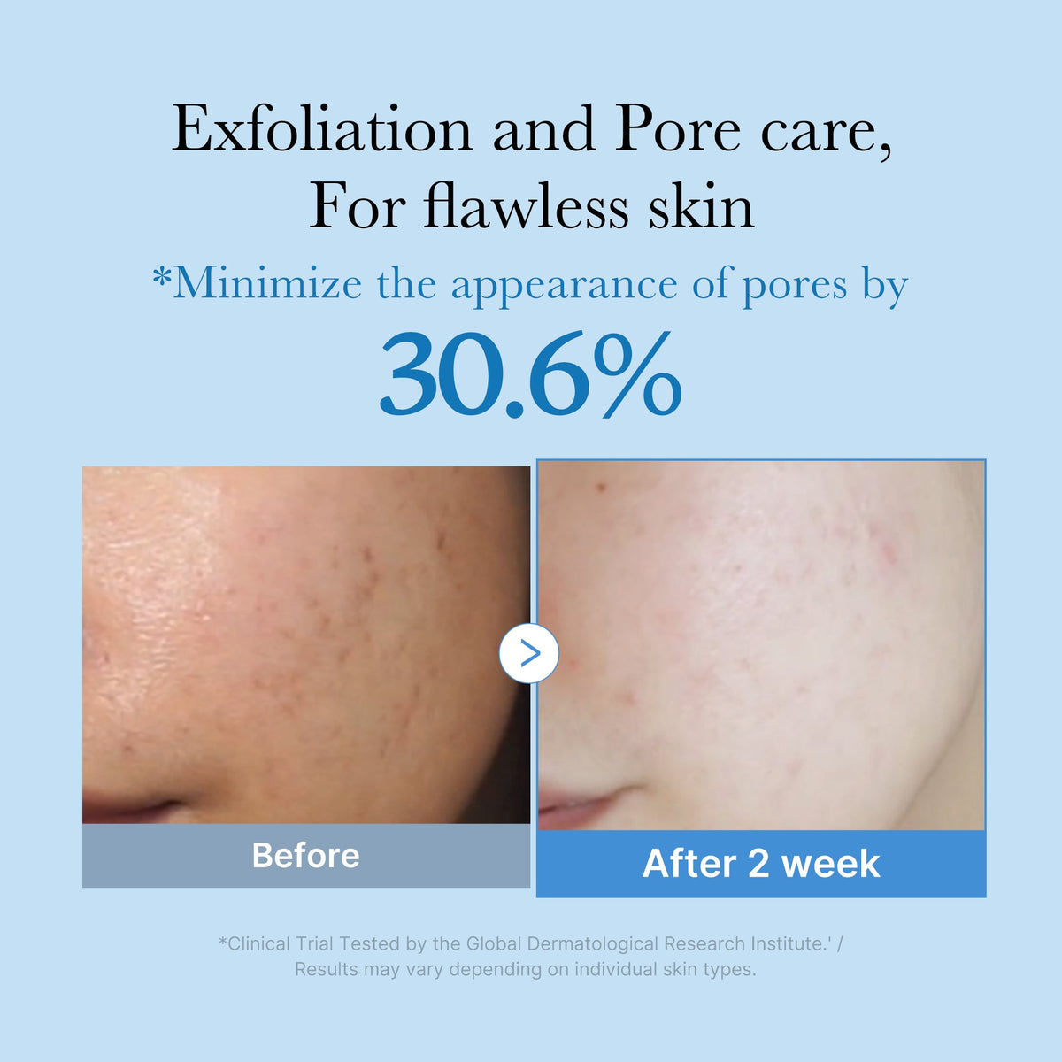 Zero Pore Toner O3