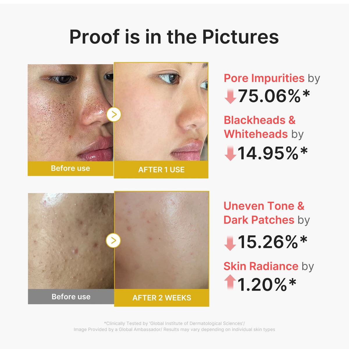 Kojic Acid Turmeric Peel Shot M5