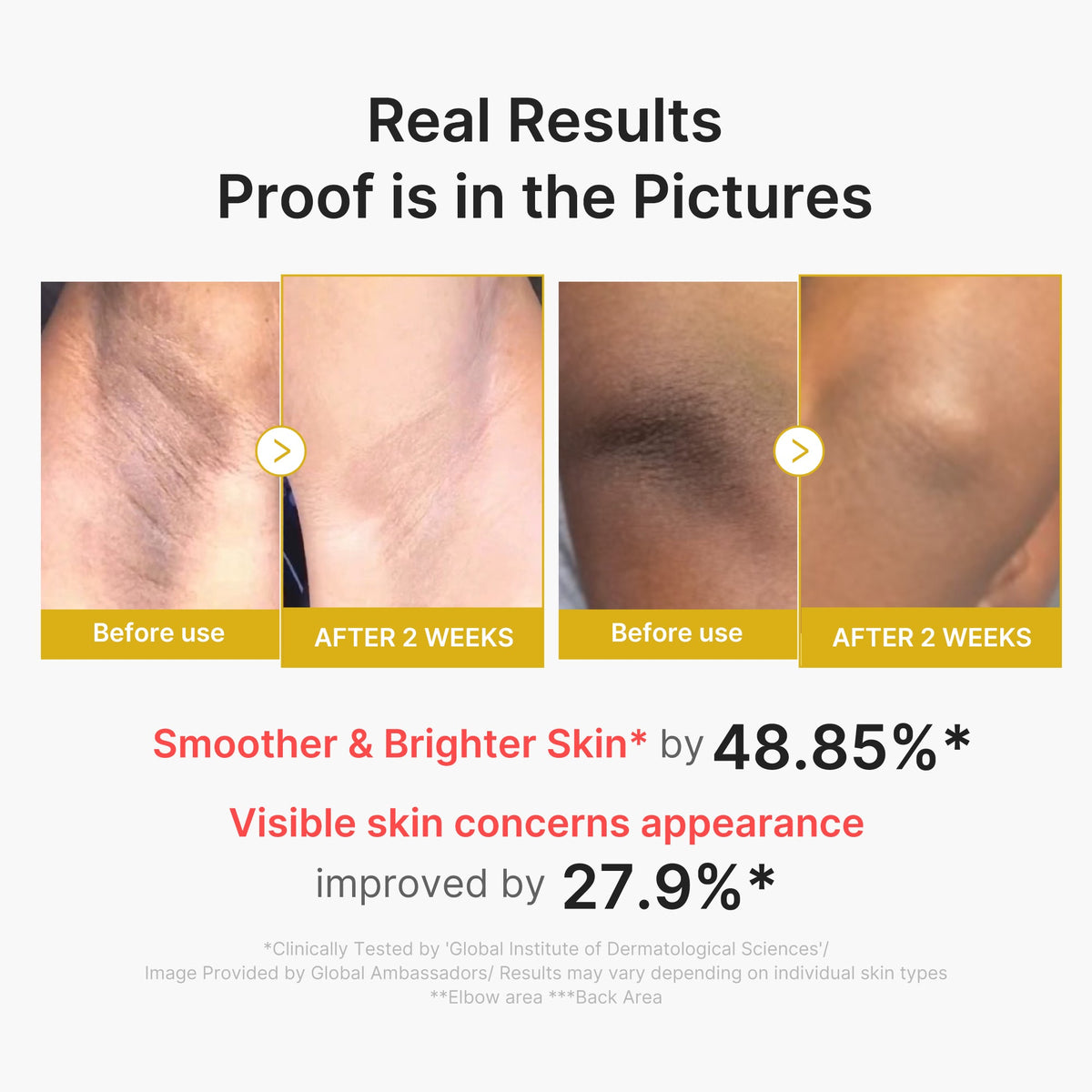 Kojic Acid Turmeric Body Peel Shot U0