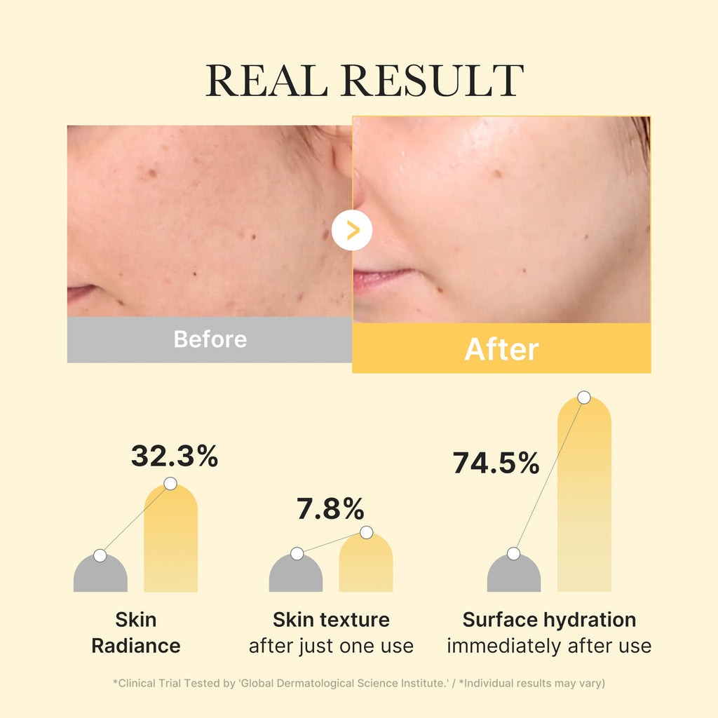 Kojic Acid Turmeric Gold Jelly Gel Mask X2