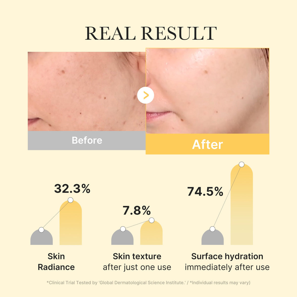 Kojic Acid Turmeric Gold Jelly Gel Mask X2