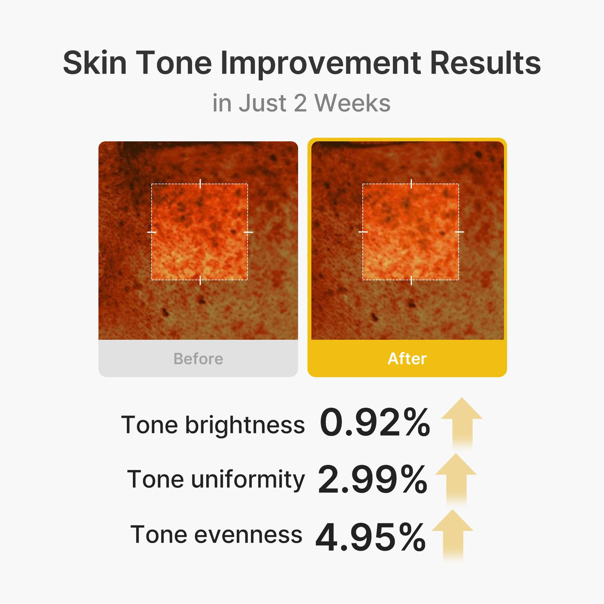 Kojic Acid Turmeric Vita Capsule Cream Y5