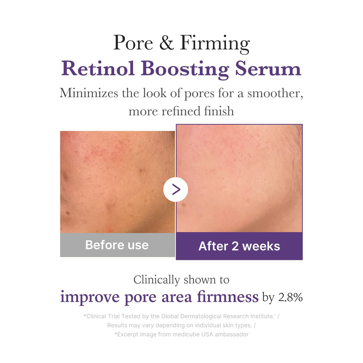 Retinol NMN Boosting Serum D6