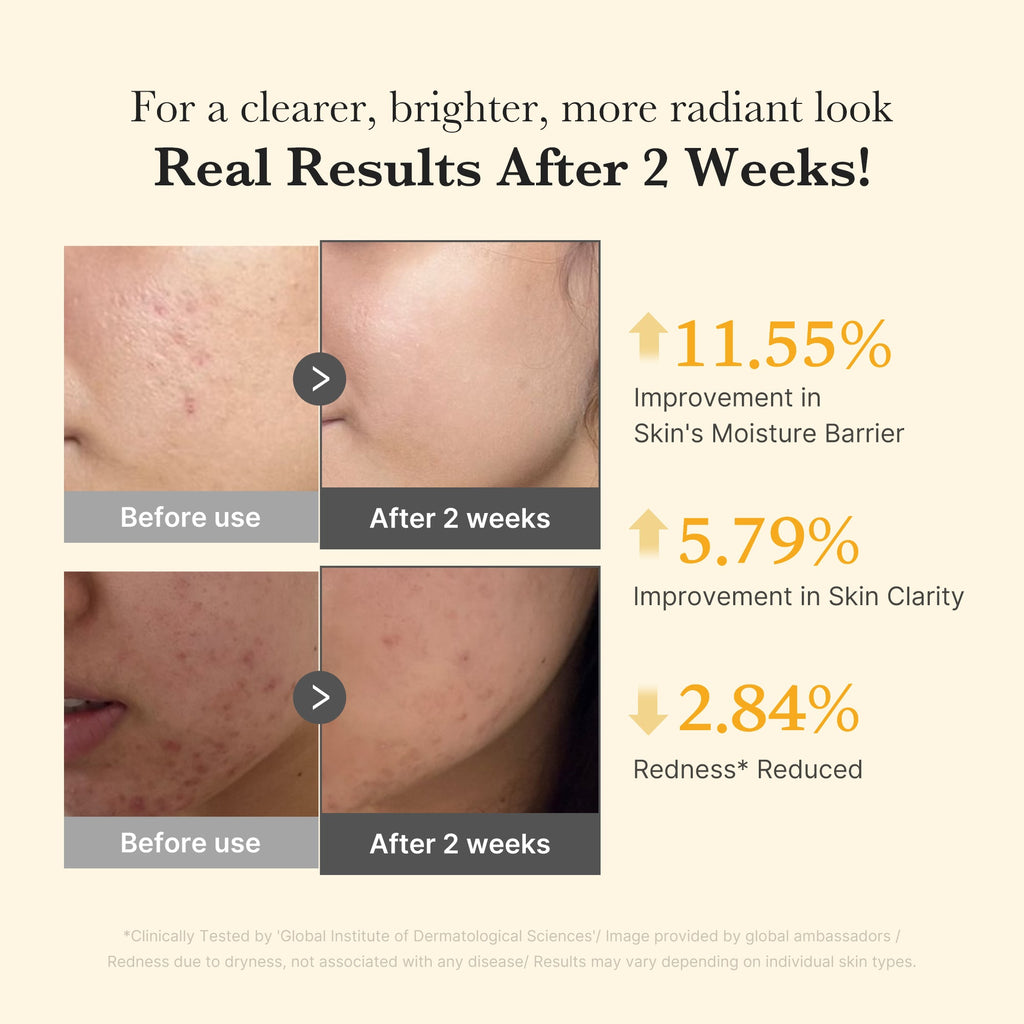Kojic Acid Turmeric Capsule Serum X2