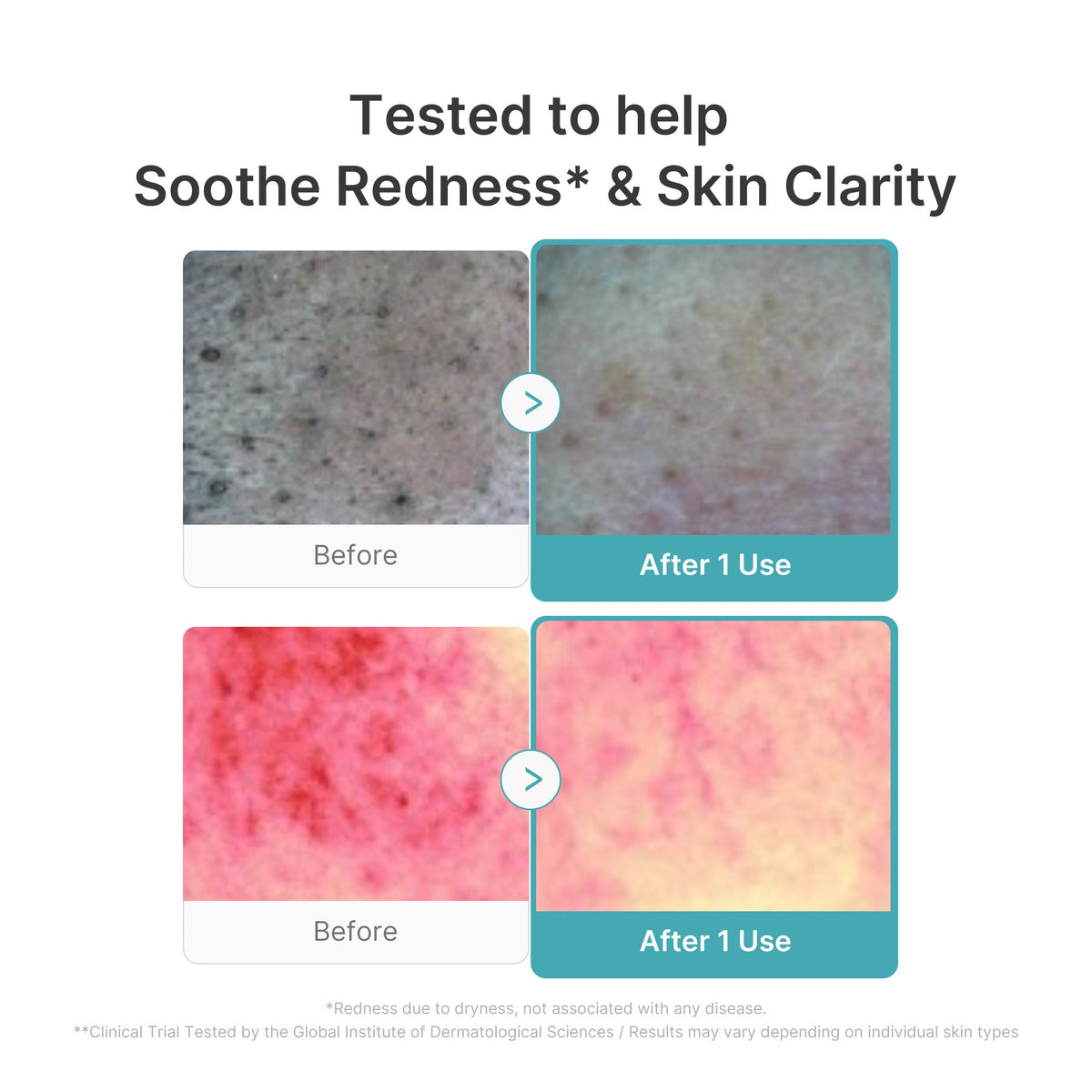 Azelaic Acid Capsule Foam Cleanser T6