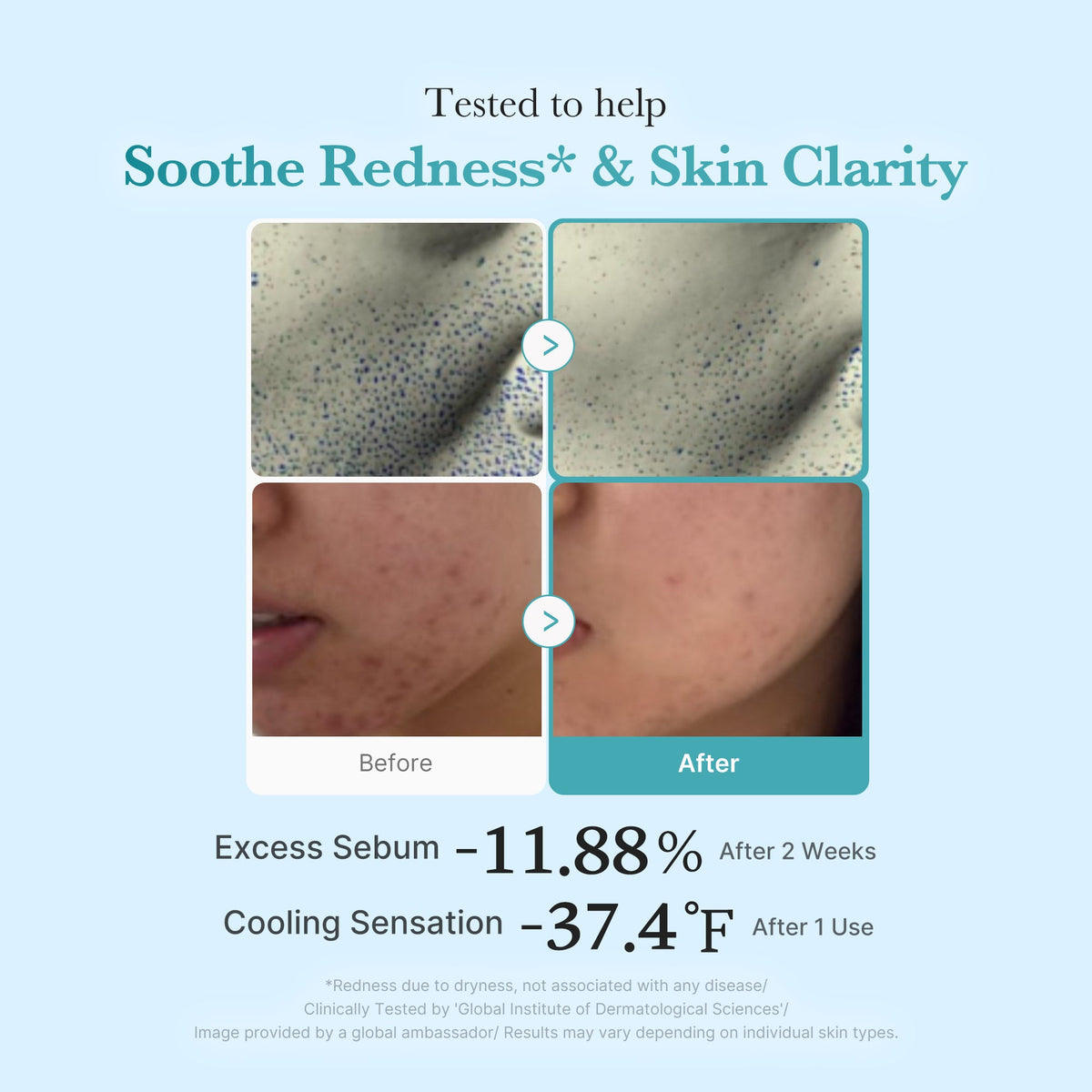 Azelaic Acid Niacinamide Clarifying Toner U2