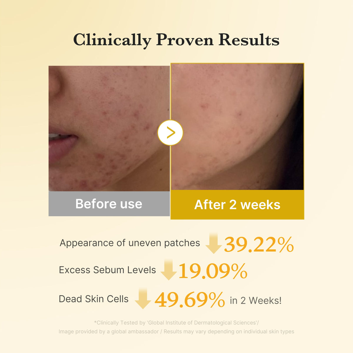 Kojic Acid Tumeric Toner Pad M1