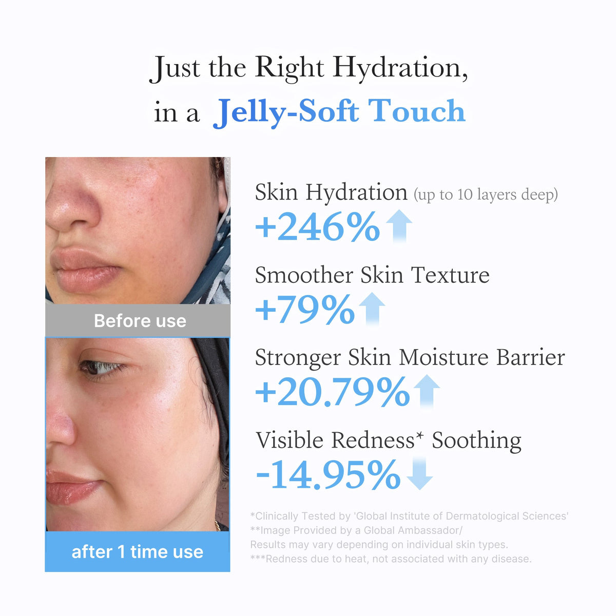 Hyaluronic Ceramide Moisturizing Jelly Cream B1