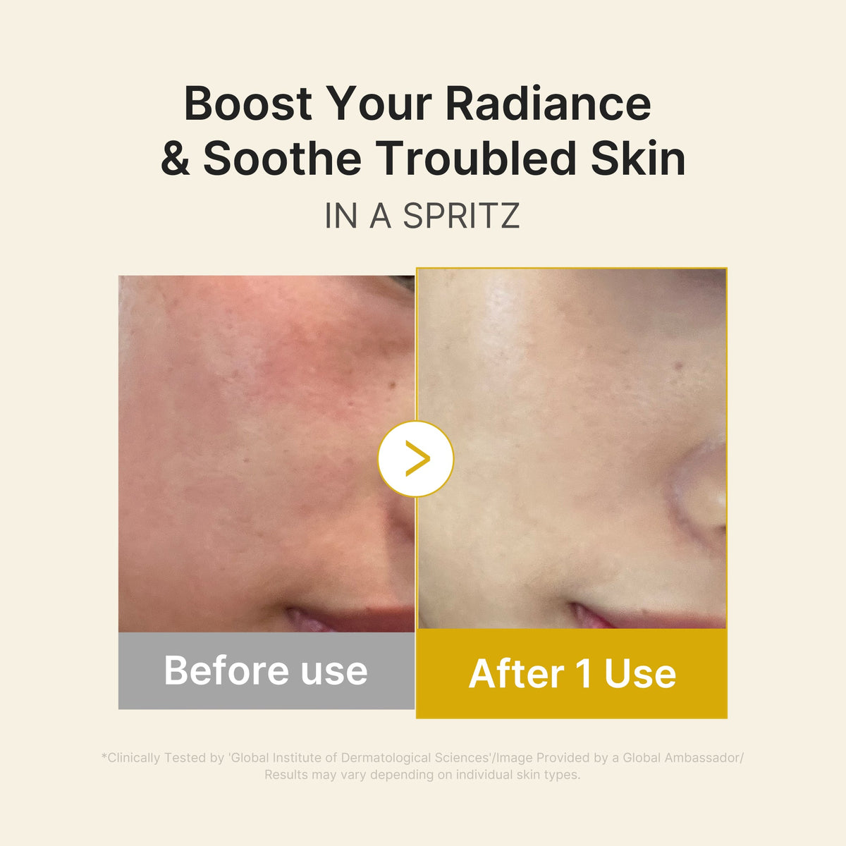 Kojic Acid Turmeric Vitamin Gold Jelly Mist Serum M5
