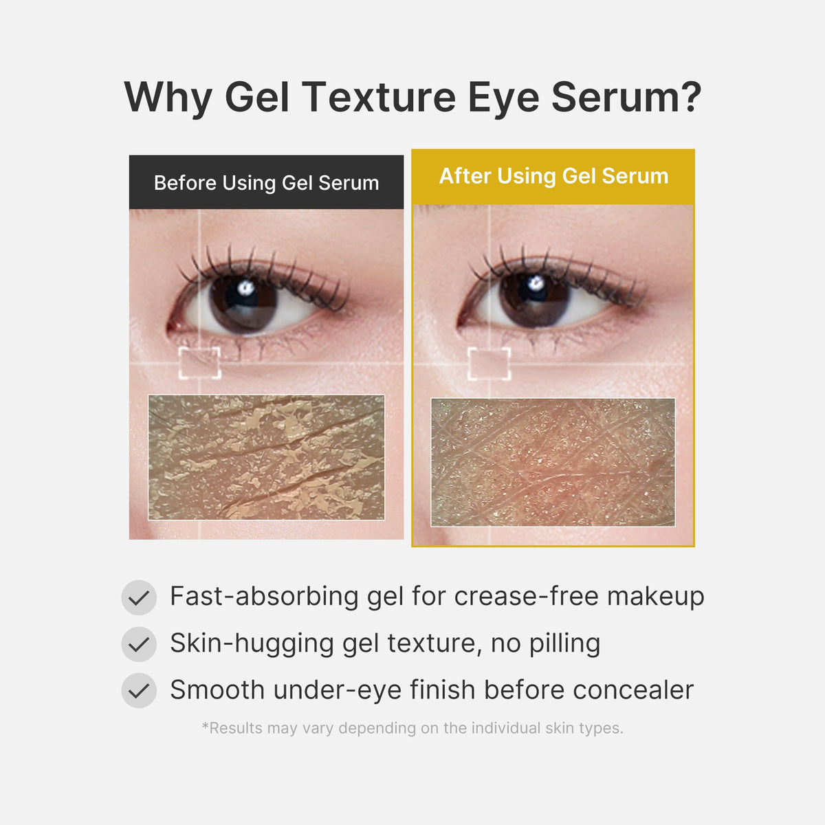 Kojic Acid Tumeric Eye Gel Serum I5