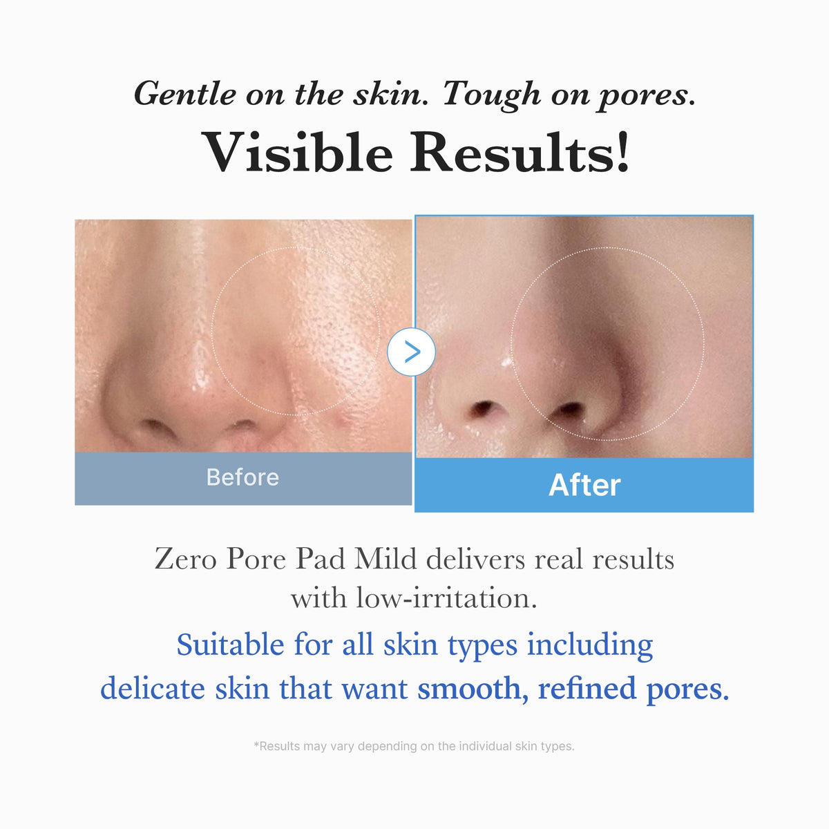 Zero Pore Madecassoside Pads (Mild) H3