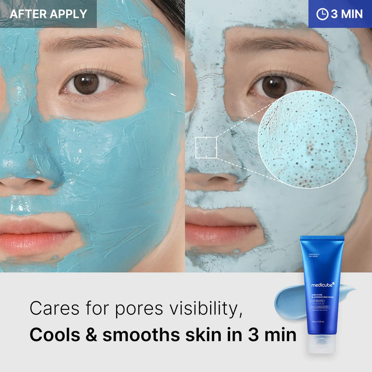 Zero Pore Blackhead Mud Mask Y4