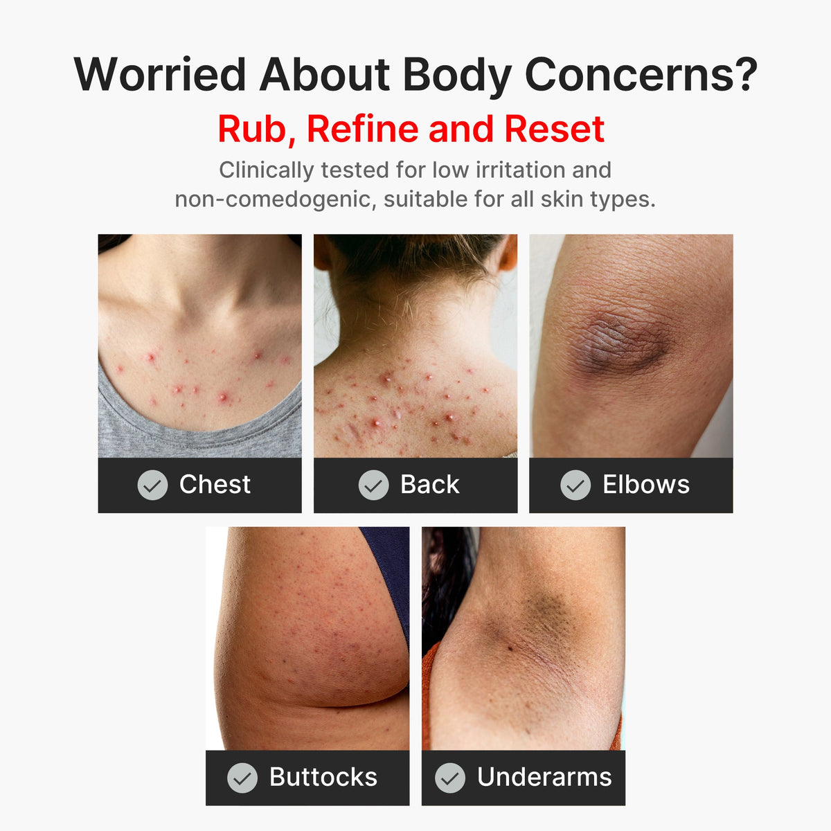 Kojic Acid Turmeric Body Peel Shot U0