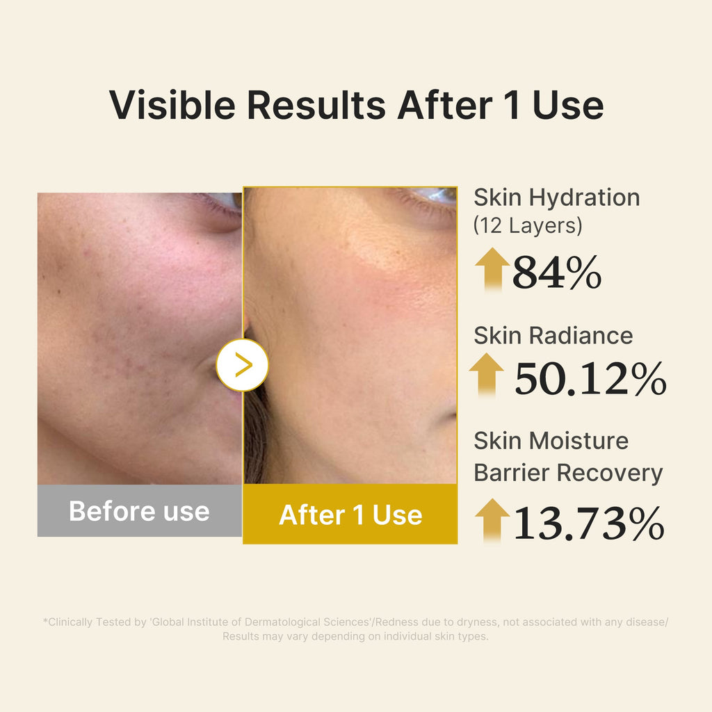 Kojic Acid Turmeric Vitamin Gold Jelly Mist Serum M5
