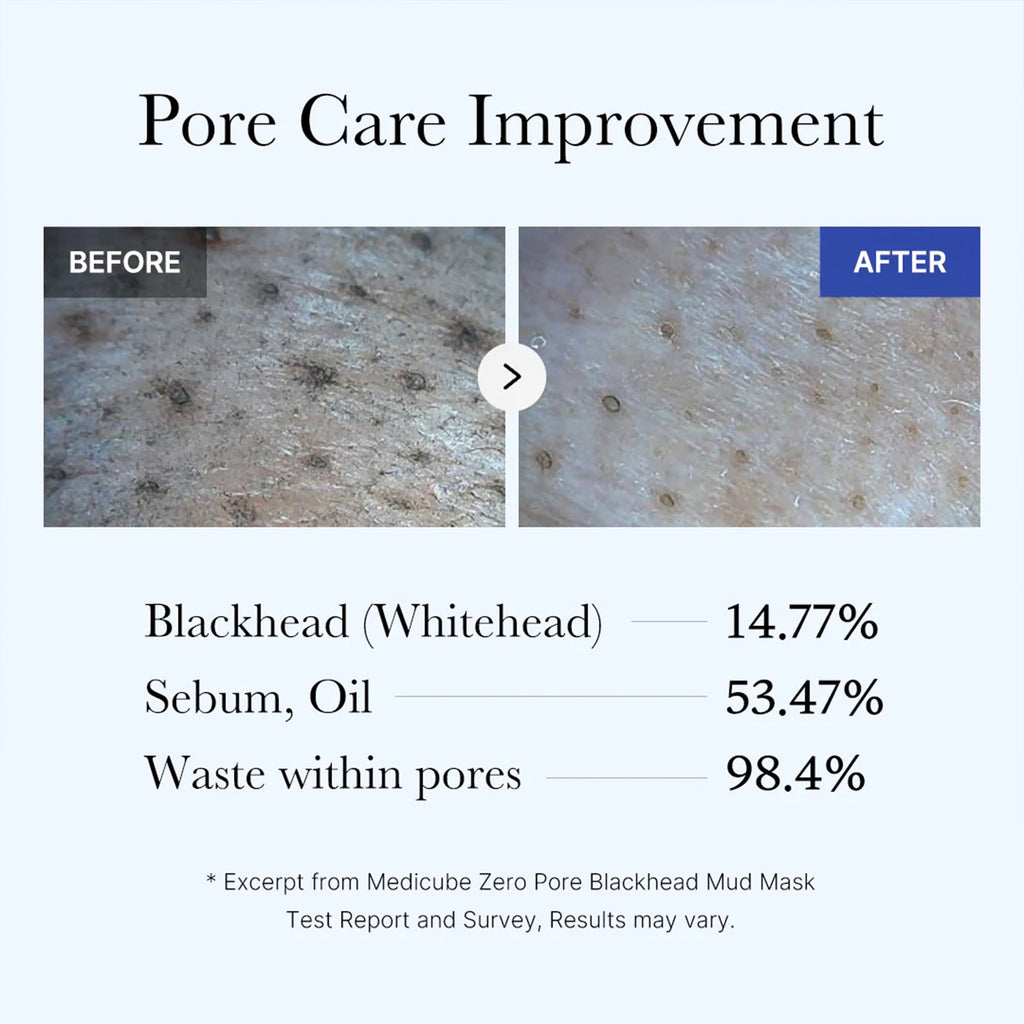 Zero Pore Blackhead Mud Mask Y4