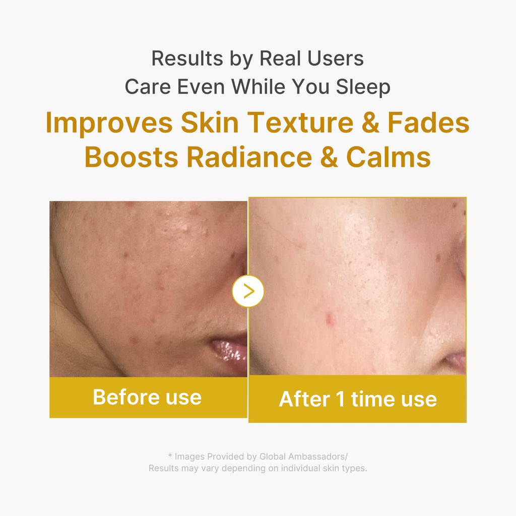 Kojic Acid Turmeric Overnight Wrapping Mask I7