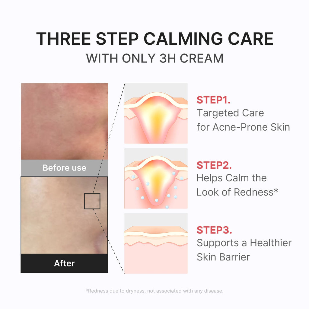3H Daily Relief Cream W1