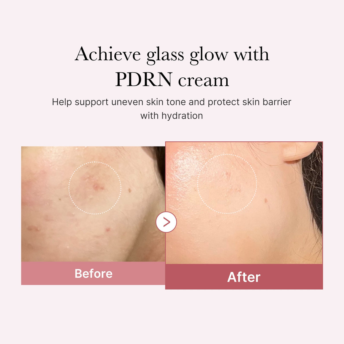 PDRN Pink Peptide Cream Q0