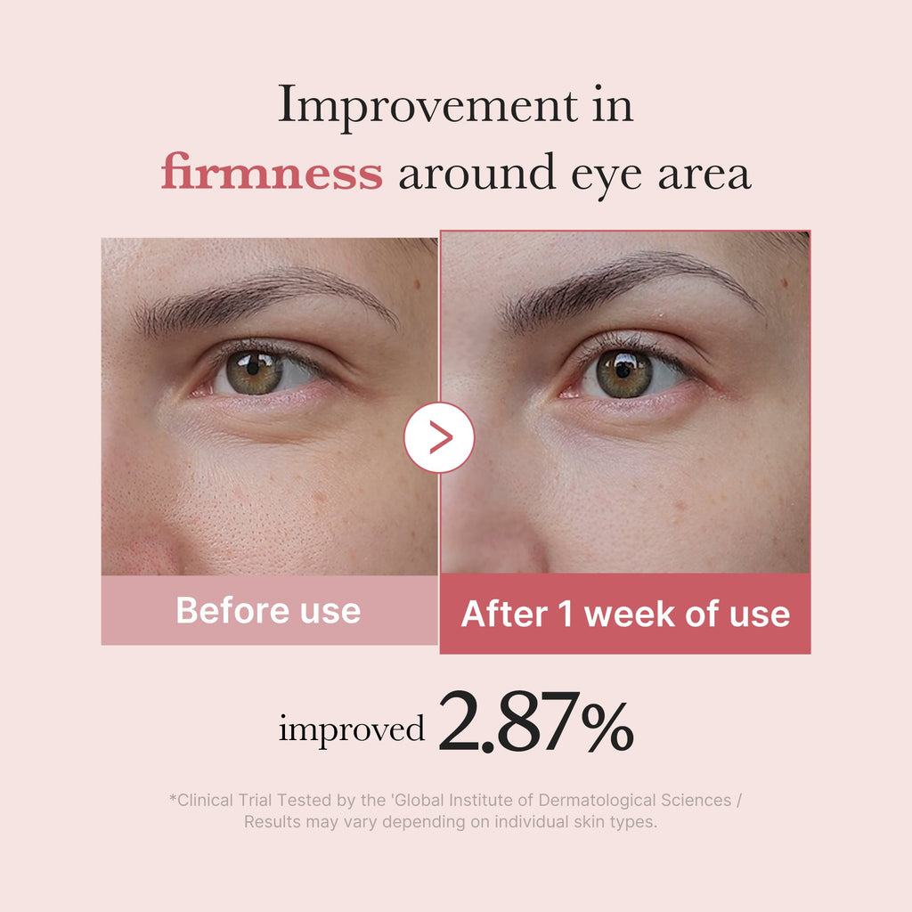 PDRN Pink Peptide Eye Cream Z1