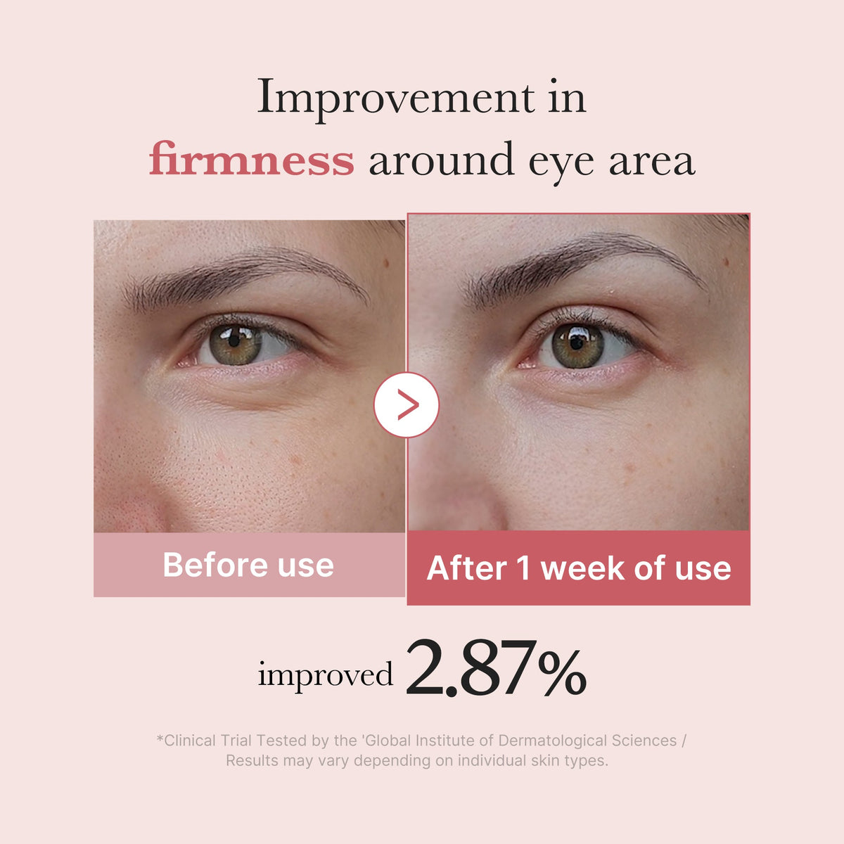 PDRN Pink Peptide Eye Cream Z1