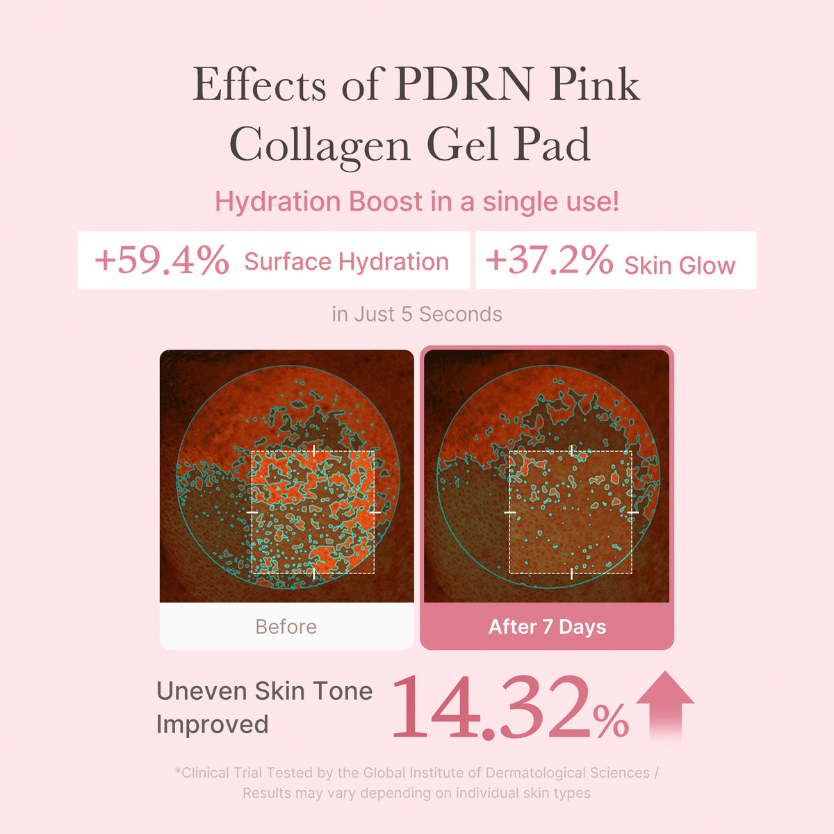 PDRN Pink Collagen Gel Toner Pad Y3