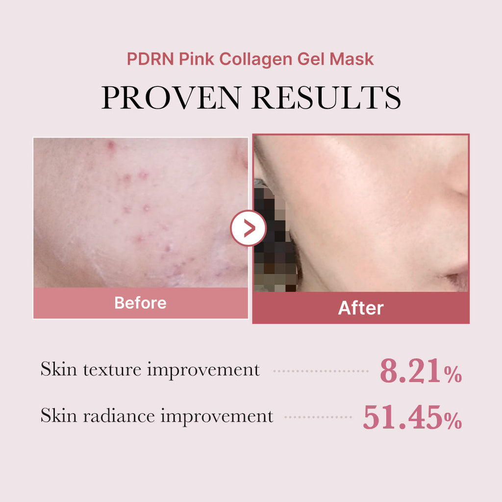 Salmon PDRN Pink Collagen Jelly Gel Mask V1