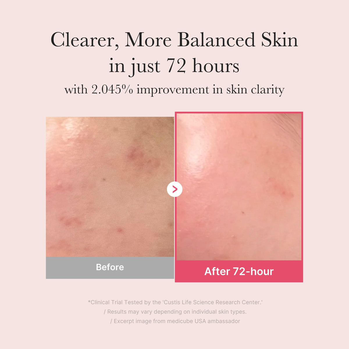 TXA Niacinamide Serum F4