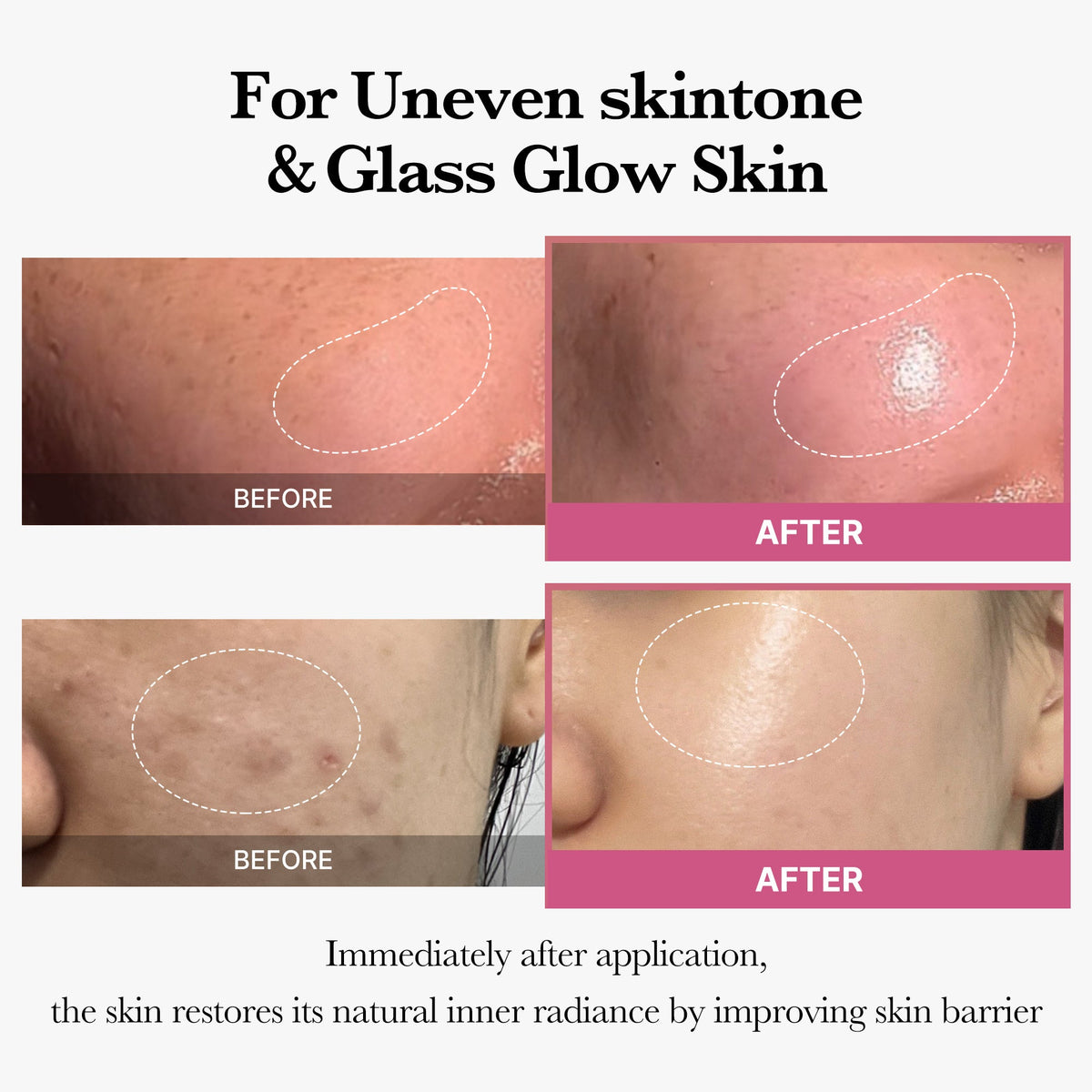 [Tati's Exclusive] All About Glow Set Y7
